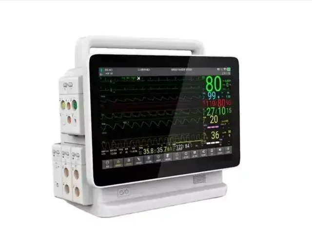 Monitoring Equipment Frames