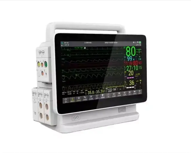 Monitoring Equipment Frames