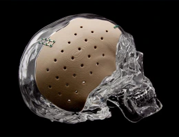 Medical Devices & Equipment: